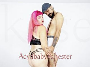 Acydbabyxchester